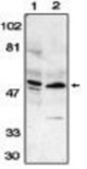Western blot of anti-ZIPK antibody on HeLa (1) and Jurkat (2) whole cell lysates