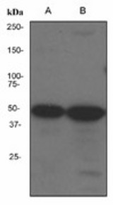 Western blot analysis on (A) HeLa and (B) A431 cell lysates using anti- DAPK3 antibody (LS-C105519), dilution: 1:5000.