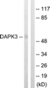 Western blot of extracts from HUVEC cells, using DAPK3 (Ab-265) Antibody. The lane on the right is treated with the synthesized peptide.
