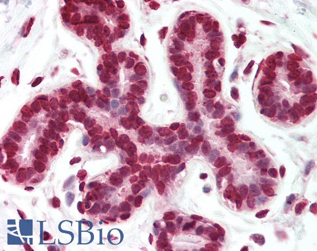 Human Breast: Formalin-Fixed, Paraffin-Embedded (FFPE)