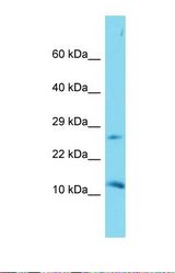 Western blot of Mouse Kidney. Dapl1 antibody dilution 1.0 ug/ml.
