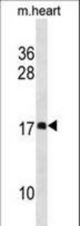 DAPL1 Antibody western blot of mouse heart tissue lysates (35 ug/lane). The DAPL1 antibody detected the DAPL1 protein (arrow).