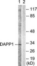 Western blot of extracts from 293 cells, treated with Insulin 0.01U/ml 2', using DAPP1 Antibody. The lane on the right is treated with the synthesized peptide.