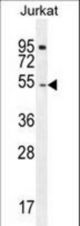 DARS Antibody western blot of Jurkat cell line lysates (35 ug/lane). The DARS antibody detected the DARS protein (arrow).