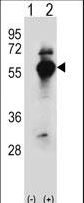 Western blot of DARS (arrow) using rabbit polyclonal DARS Antibody. 293 cell lysates (2 ug/lane) either nontransfected (Lane 1) or transiently transfected (Lane 2) with the DARS gene.
