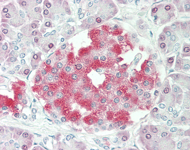 Human Pancreas: Formalin-Fixed, Paraffin-Embedded (FFPE)