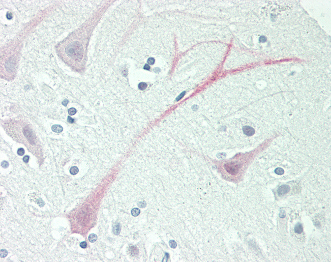 Human Brain, Cortex: Formalin-Fixed, Paraffin-Embedded (FFPE)