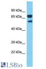 DARS antibody Western Blot of Human Fetal Lung . Antibody dilution: 1 ug/ml.