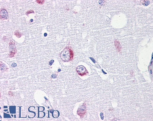 Anti-DARS antibody IHC of human brain, cortex. Immunohistochemistry of formalin-fixed, paraffin-embedded tissue after heat-induced antigen retrieval. Antibody LS-B4310 concentration 5 ug/ml.