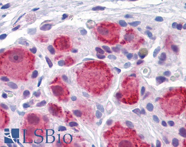 Anti-DARS antibody IHC of human ganglion cells. Immunohistochemistry of formalin-fixed, paraffin-embedded tissue after heat-induced antigen retrieval. Antibody LS-B4310 concentration 5 ug/ml.