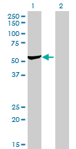 Western blot of DARS expression in transfected 293T cell line by DARS monoclonal antibody, clone 2F11.