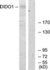 Western blot of extracts from 293 cells, using DIDO1 Antibody. The lane on the right is treated with the synthesized peptide.