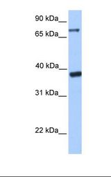 Transfected 293T cell lysate. Antibody concentration: 1.0 ug/ml. Gel concentration: 12%.