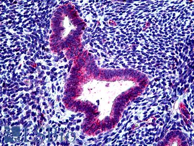 Anti-CLCN2 antibody IHC of human uterus. Immunohistochemistry of formalin-fixed, paraffin-embedded tissue after heat-induced antigen retrieval. Antibody LS-B5141 concentration 3.75 ug/ml.