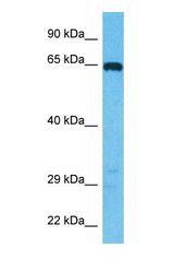 Western blot of DIDO1 Antibody with human Jurkat Whole Cell lysate.
