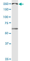 DIDO1 monoclonal antibody (M04), clone 3B1. Western blot of DIDO1 expression in HepG2.