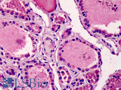 Anti-DIDO1 / DATF1 antibody IHC of human thyroid. Immunohistochemistry of formalin-fixed, paraffin-embedded tissue after heat-induced antigen retrieval. Antibody LS-B1519 concentration 5 ug/ml.