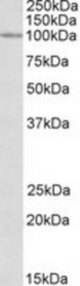 CLCN2 antibody (0.3 ug/ml) staining of HeLa lysate (35 ug protein/ml in RIPA buffer). Primary incubation was 1 hour. Detected by chemiluminescence.