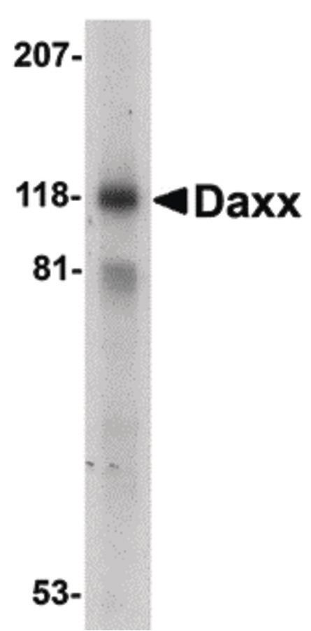 Western blot of Daxx in 293 total cell lysate with Dax antibody at 1 mg/ml.