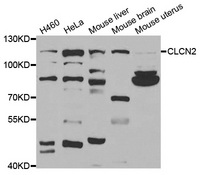 Western blot analysis of extracts of various cell lines, using CLCN2 antibody.