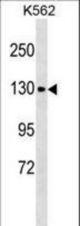 CHERP Antibody western blot of K562 cell line lysates (35 ug/lane). The CHERP antibody detected the CHERP protein (arrow).