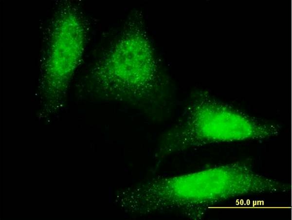 Immunofluorescence of monoclonal antibody to DAZ1 on HeLa cell. [antibody concentration 10 ug/ml].