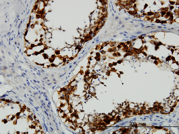 Immunoperoxidase of monoclonal antibody to DAZ1 on formalin-fixed paraffin-embedded human testis. [antibody concentration 1 ug/ml]