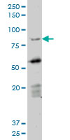 DAZ1 monoclonal antibody (M06), clone 3E3. Western blot of DAZ1 expression in Daoy.