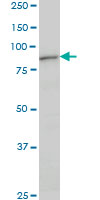 DAZ1 monoclonal antibody (M09), clone 3A4. Western blot of DAZ1 expression in human placenta.