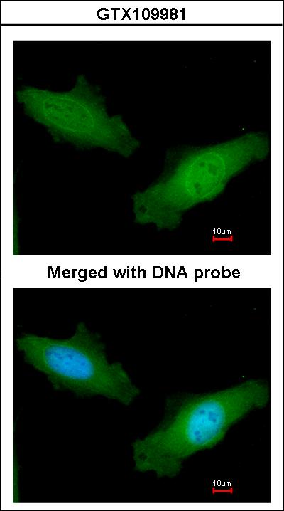 Immunofluorescence of paraformaldehyde-fixed HeLa using DAZ2 antibody at 1:200 dilution.