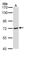 Sample (30 ug of whole cell lysate). A: Molt-4 . 7.5% SDS PAGE. DAZ2 antibody diluted at 1:1000