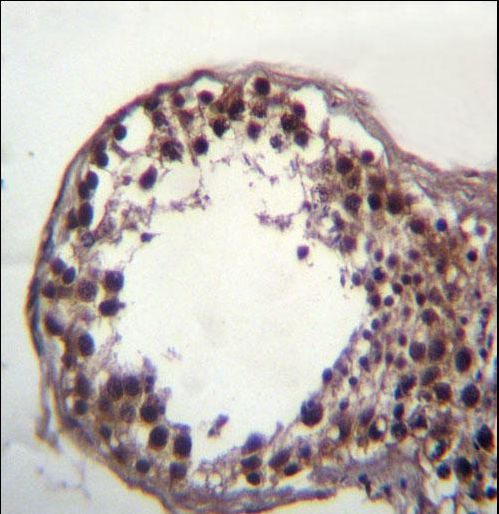 DAZ3 Antibody immunohistochemistry of formalin-fixed and paraffin-embedded human testis tissue followed by peroxidase-conjugated secondary antibody and DAB staining.