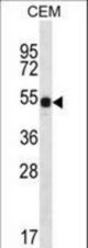 DAZ3 Antibody western blot of CEM cell line lysates (35 ug/lane). The DAZ3 antibody detected the DAZ3 protein (arrow).