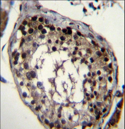 DAZ4 Antibody immunohistochemistry of formalin-fixed and paraffin-embedded human testis tissue followed by peroxidase-conjugated secondary antibody and DAB staining.