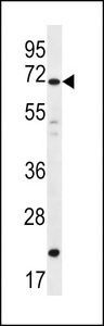 DAZ4 Antibody western blot of A549 cell line lysates (35 ug/lane). The DAZ4 antibody detected the DAZ4 protein (arrow).