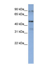 DAZAP1 antibody LS-C110583 Western blot of Jurkat lysate.