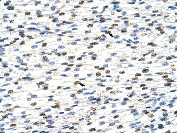 DAZAP1 antibody LS-C30971 was used in IHC to stain formalin-fixed, paraffin-embedded human heart.