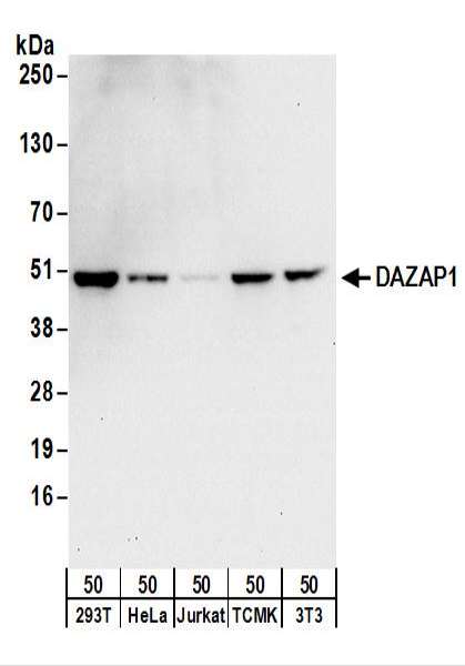 Detection of Human and Mouse DAZAP1 by Western Blot. Samples: Whole cell lysate (50 ug) from 293T, HeLa, Jurkat, mouse TCMK-1, and mouse NIH3T3 cells. Antibodies: Affinity purified rabbit anti-DAZAP1 antibody used for WB at 0.4 ug/ml. Detection: Chemiluminescence with an exposure time of 10 seconds.