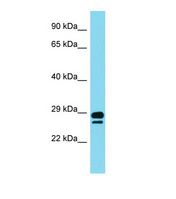 Western blot of Human Stomach tumor. DAZL antibody dilution 1.0 ug/ml.