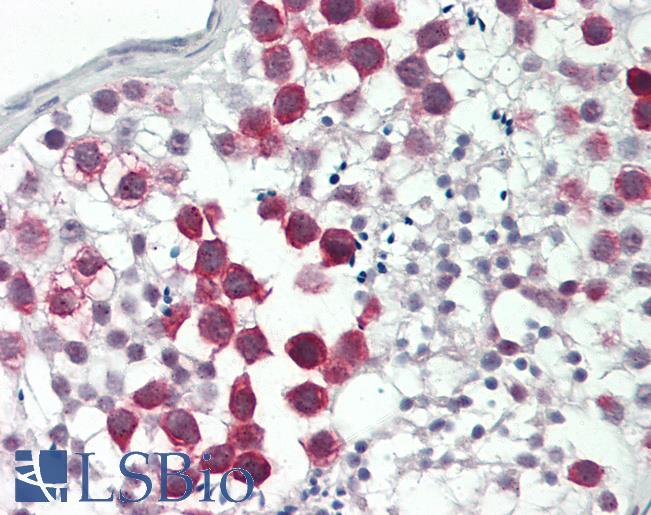 Human Testis: Formalin-Fixed, Paraffin-Embedded (FFPE)