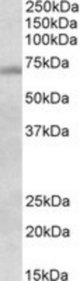 DBF4 antibody (1 ug/ml) staining of Mouse Testis lysate (35 ug protein/ml in RIPA buffer). Primary incubation was 1 hour. Detected by chemiluminescence.