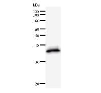 Western blot analysis of immunized recombinant protein, using anti-DBF4 monoclonal antibody.