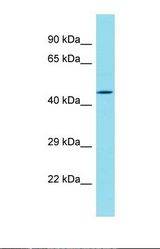 Western blot of Human HeLa. DBF4B antibody dilution 1.0 ug/ml.