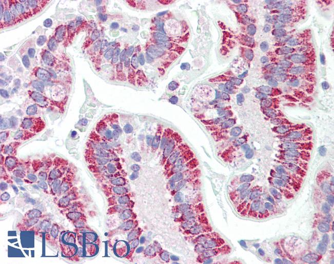 Anti-DBP5 / SON antibody IHC staining of human small intestine. Immunohistochemistry of formalin-fixed, paraffin-embedded tissue after heat-induced antigen retrieval. Antibody LS-B9539 concentration 5 ug/ml.