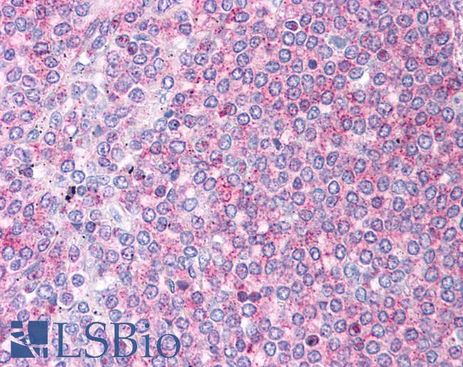 Anti-DBT / E2 antibody IHC of human spleen. Immunohistochemistry of formalin-fixed, paraffin-embedded tissue after heat-induced antigen retrieval. Antibody LS-B4677 concentration 5 ug/ml.