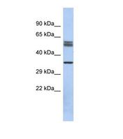 Western blot of Human Fetal Kidney. DBT antibody dilution 1.0 ug/ml.