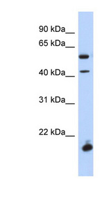 DBX1 antibody LS-C102360 Western blot of Fetal Spleen lysate.