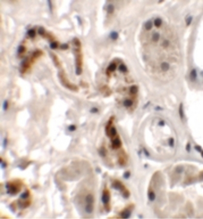 Immunohistochemistry of DBX1 in human kidney tissue with DBX1 antibody at 2.5 ug/ml.