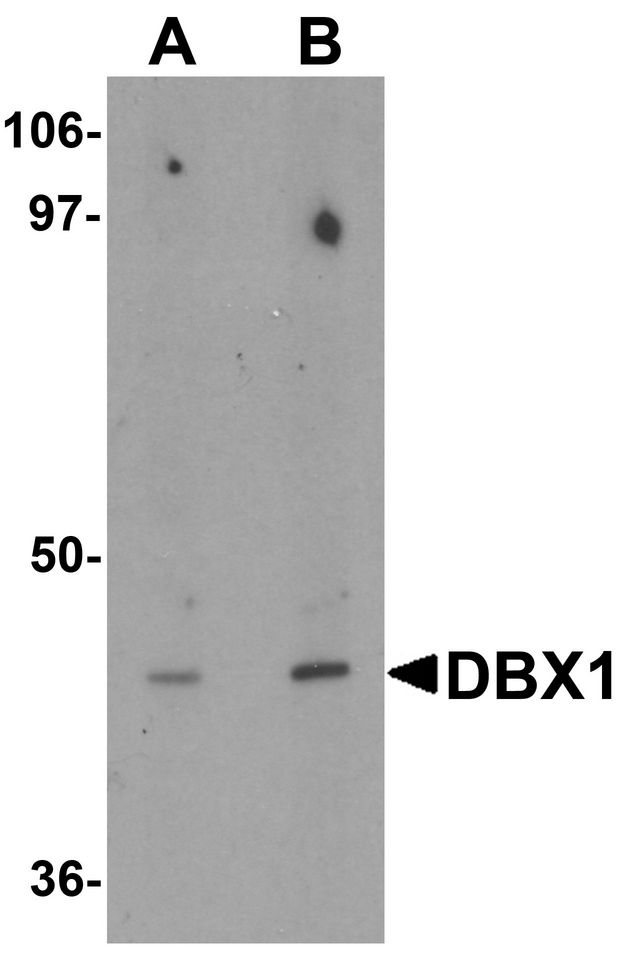Western blot analysis of DBX1 in mouse kidney tissue lysate with DBX1 antibody at (A) 1 and (B) 2 ug/ml.