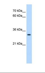 HepG2 cell lysate. Antibody concentration: 0.25 ug/ml. Gel concentration: 12%.